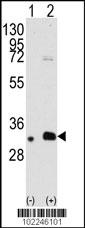 Rabbit anti-MAGEB2 Polyclonal Antibody(N-term)