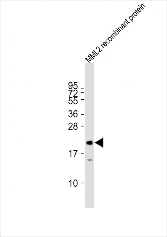 Rabbit anti-MLL2 Polyclonal Antibody(C-term)