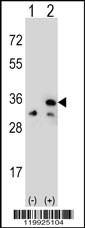 Rabbit anti-VDAC1 Polyclonal Antibody(Center)