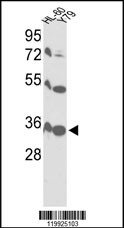 Rabbit anti-VDAC1 Polyclonal Antibody(Center)
