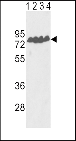Rabbit anti-ECE-1 Polyclonal Antibody(Center)