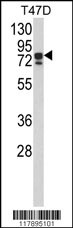 Rabbit anti-KHSRP Polyclonal Antibody(N-term)