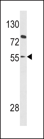 Rabbit anti-PAX8 Polyclonal Antibody(Center)