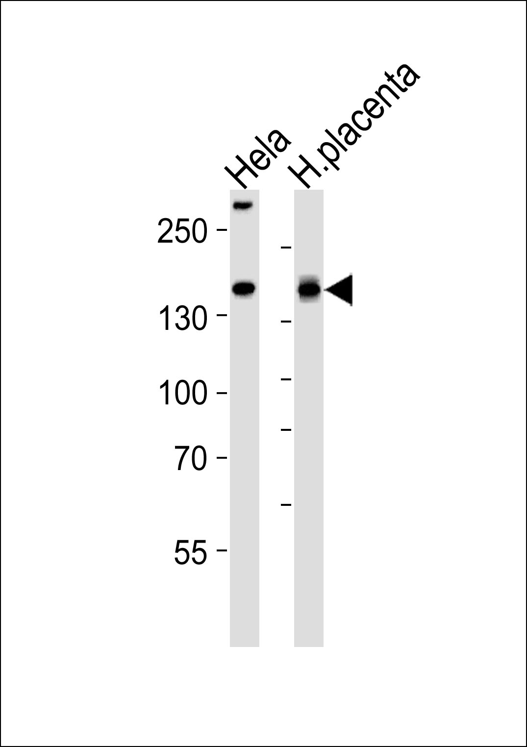 Rabbit anti-COL4A1 Polyclonal Antibody(N-term)