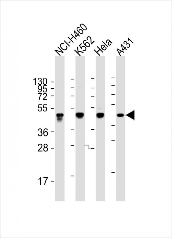 Rabbit anti-CYK18 Polyclonal Antibody(C-term)