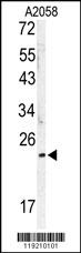 Rabbit anti-MOBKL1B Polyclonal Antibody(C-term)