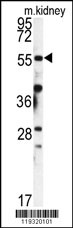 Rabbit anti-FKBP9 Polyclonal Antibody(N-term)