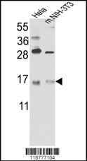 Rabbit anti-RBM3 Polyclonal Antibody(C-term)