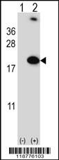 Rabbit anti-RBM3 Polyclonal Antibody(Center)