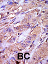 Rabbit anti-CSNK1E Polyclonal Antibody(C-term)