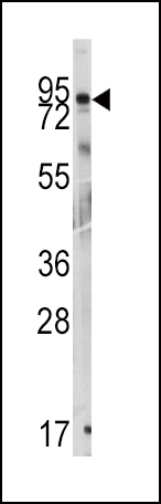 Rabbit anti-GIT1(Y510) Polyclonal Antibody
