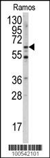 Rabbit anti-MEN1(S128) Polyclonal Antibody