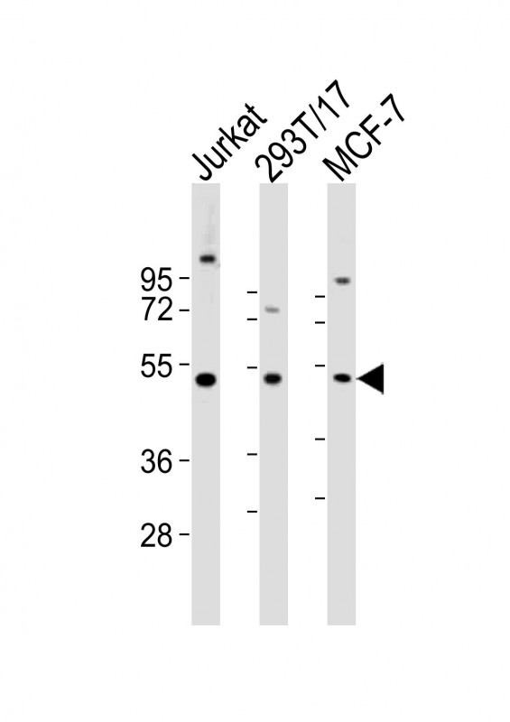 Rabbit anti-VRK1 Polyclonal Antibody(Center)