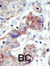 Rabbit anti-EphB3 Polyclonal Antibody(N-term)