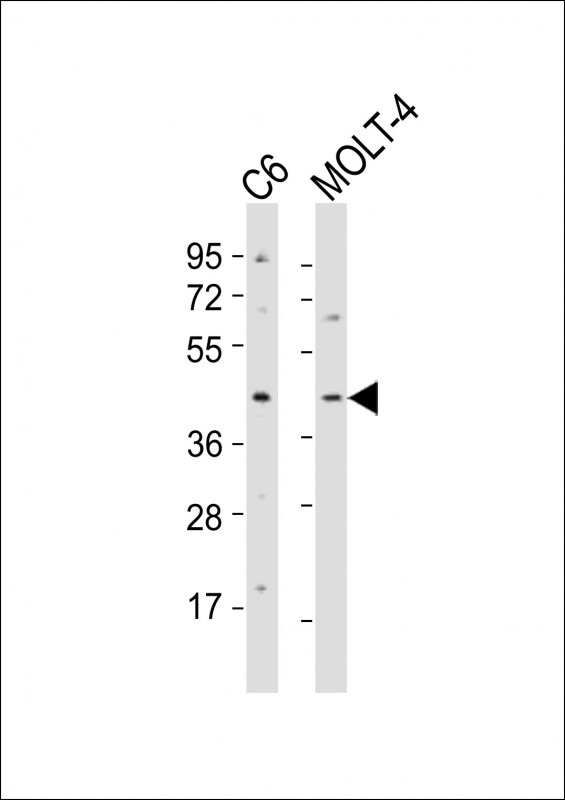 Rabbit anti-CKII α Polyclonal Antibody(Center)
