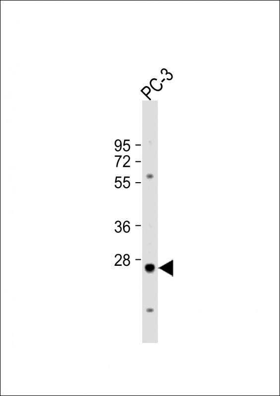 Rabbit anti-CREM Polyclonal Antibody(C-term)