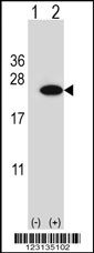 Rabbit anti-CIRBP Polyclonal Antibody(C-term)