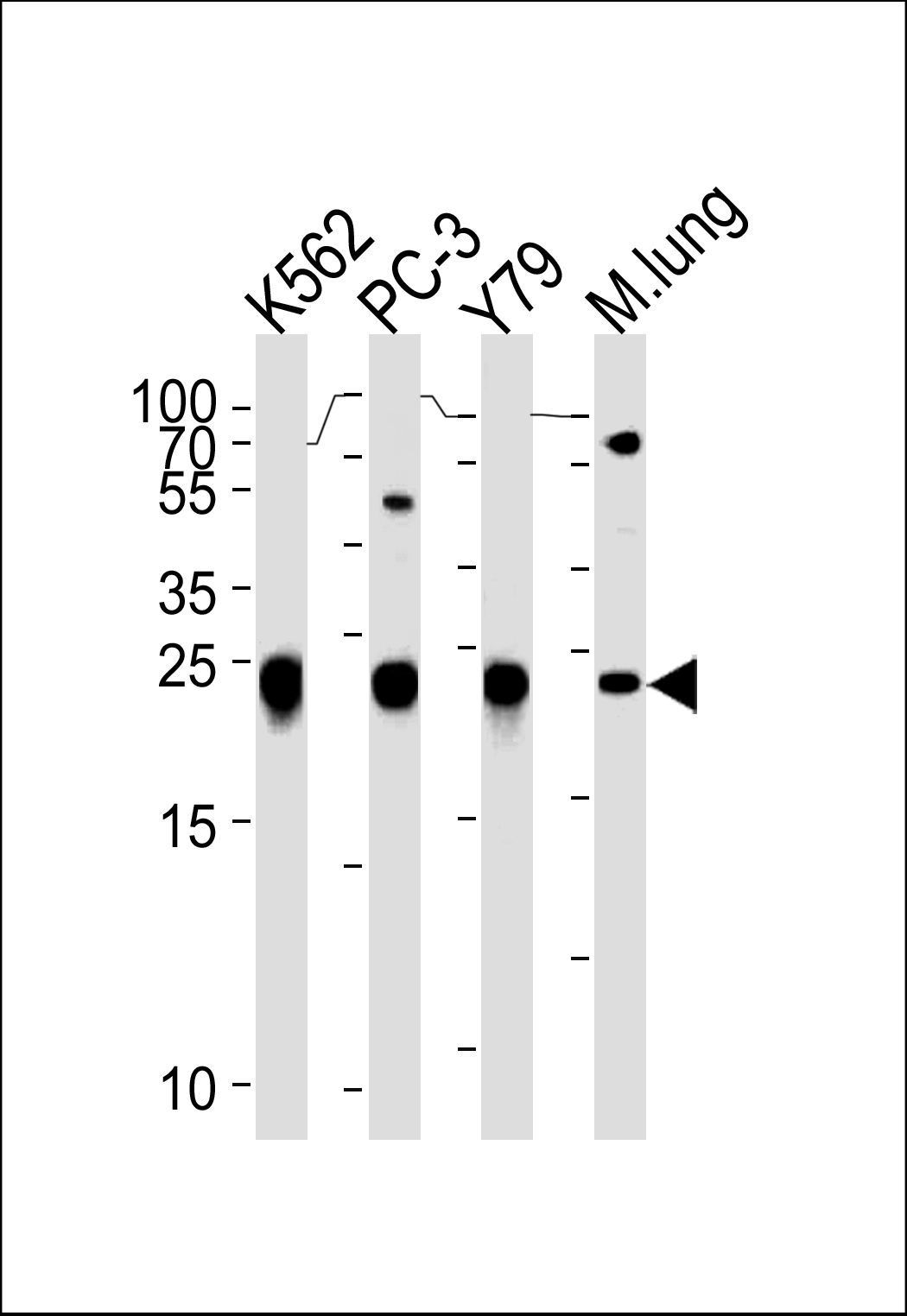 Rabbit anti-GSTP1 Polyclonal Antibody(Center)