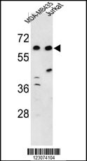 Rabbit anti-C19orf26 Polyclonal Antibody(Center)