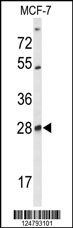 Rabbit anti-SELT Polyclonal Antibody(N-term)