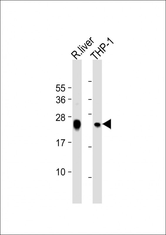 Rabbit anti-GPX1 Polyclonal Antibody(C-term)