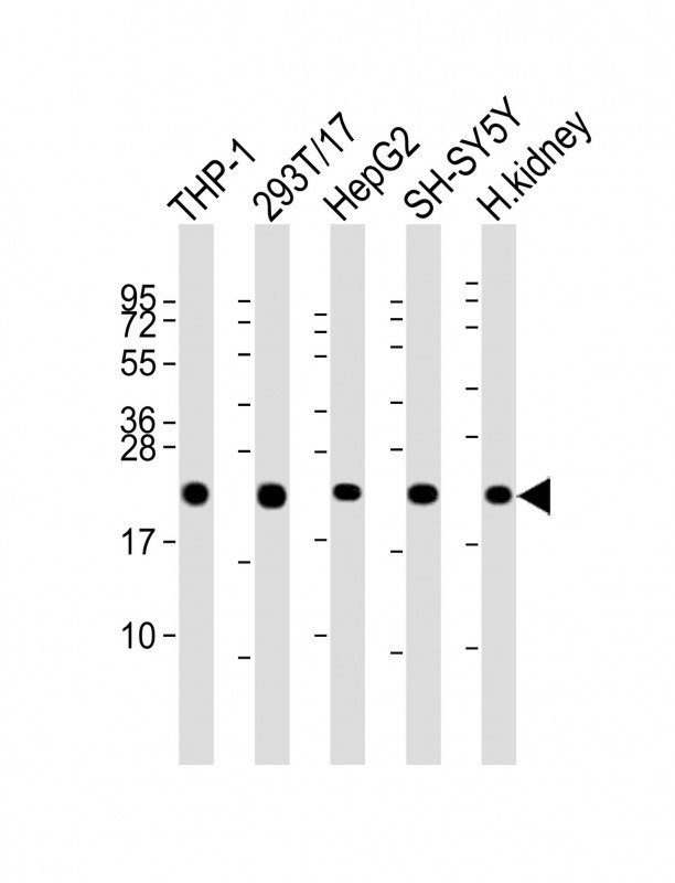 Rabbit anti-GPX1 Polyclonal Antibody(C-term)