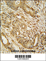 Rabbit anti-MCM2 Polyclonal Antibody(C-term)