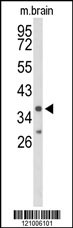 Rabbit anti-IL2RG Polyclonal Antibody(Center)
