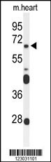 Rabbit anti-FZD4 Polyclonal Antibody(C-term)