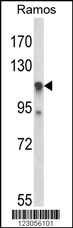 Rabbit anti-C11orf30 Polyclonal Antibody(N-term)