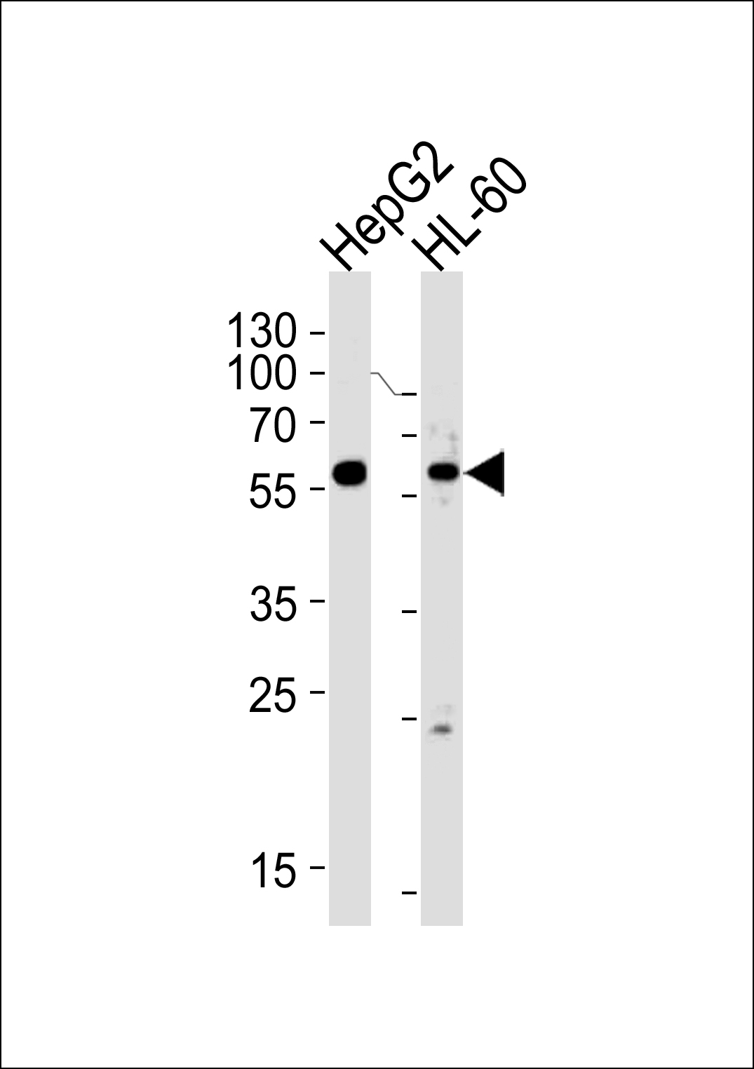 Rabbit anti-FANCC Polyclonal Antibody(C-term)