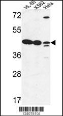 Rabbit anti-LFNG Polyclonal Antibody(Center)