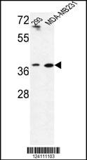 Rabbit anti-MAT2B Polyclonal Antibody(N-term)