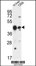 Rabbit anti-PLA1A Polyclonal Antibody(Center)
