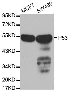 Rabbit anti-TP53 Polyclonal Antibody