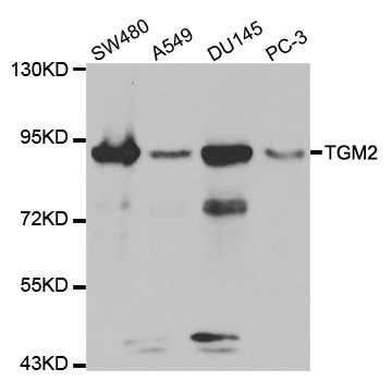 Rabbit anti-TGM2 Polyclonal Antibody