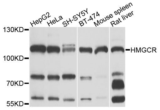 Rabbit anti-HMGCR Polyclonal Antibody