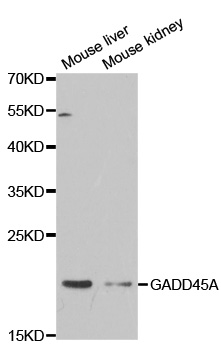 Rabbit anti-GADD45A Polyclonal Antibody