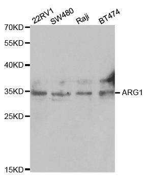Rabbit anti-ARG1 Polyclonal Antibody