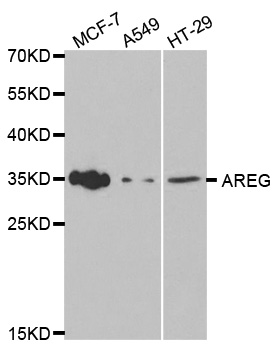 Rabbit anti-AREG Polyclonal Antibody