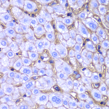 Rabbit anti-HLA-A Polyclonal Antibody