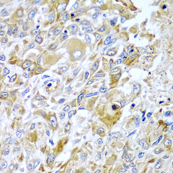 Rabbit anti-HAVCR2 Polyclonal Antibody
