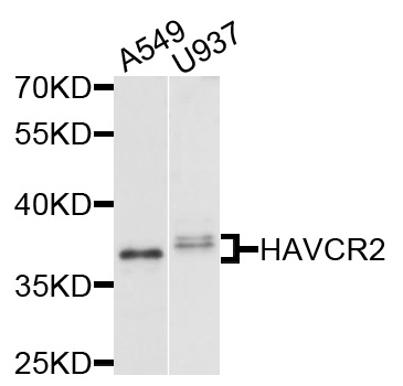 Rabbit anti-HAVCR2 Polyclonal Antibody