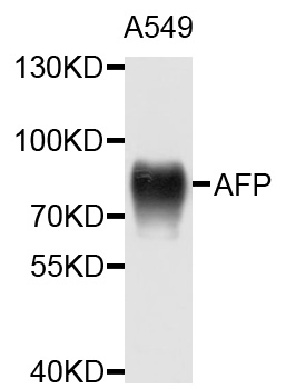 Rabbit anti-AFP Polyclonal Antibody