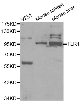 Rabbit anti-TLR1 Polyclonal Antibody