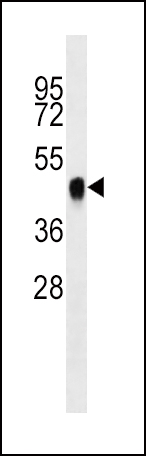 Mouse anti-BMI1 Monoclonal Antibody