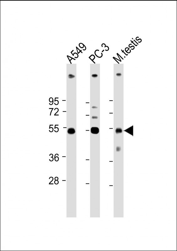 Rabbit anti-INHBB Polyclonal Antibody(C-term)