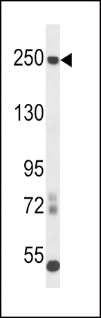 Rabbit anti-L1CAM Polyclonal Antibody(C-term)