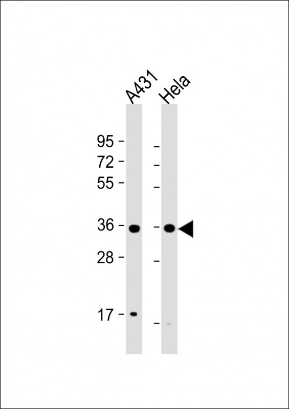 Rabbit anti-CDK7 Polyclonal Antibody(Center)
