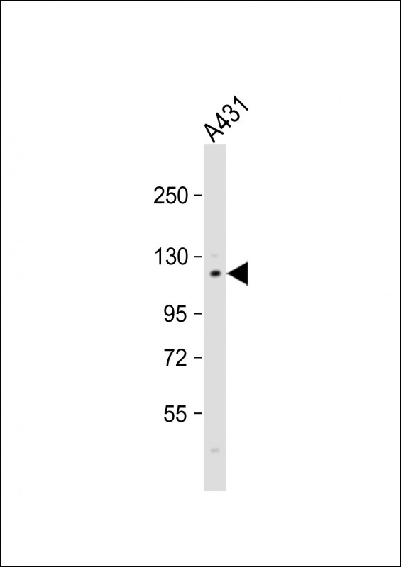 Rabbit anti-FAK1(Y576) Polyclonal Antibody